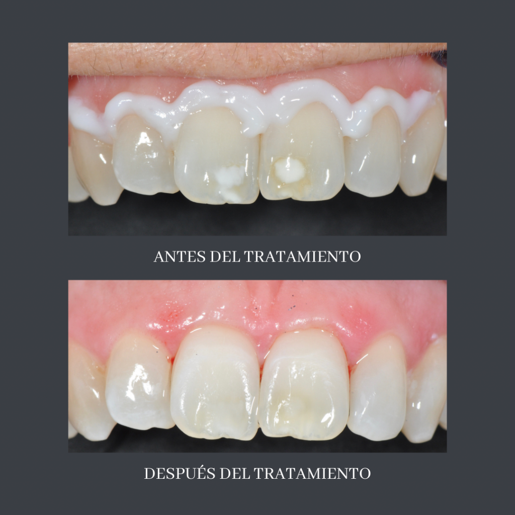 Como Quitar Manchas De Resina De La Ropa Uncategorized archivos - Clinica Smile Center